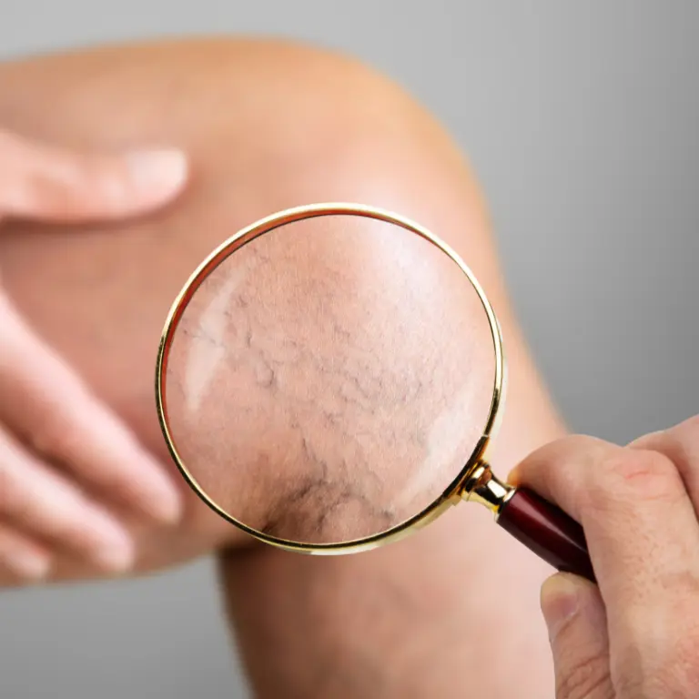 Vein specialist performing a vein screening at Vascular Surgery & Vein Care Center
